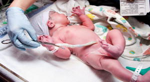 how-much-does-cord-blood-banking-cost